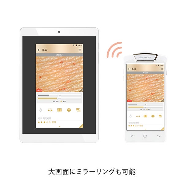 肌カウンセリングスコープ ASM
