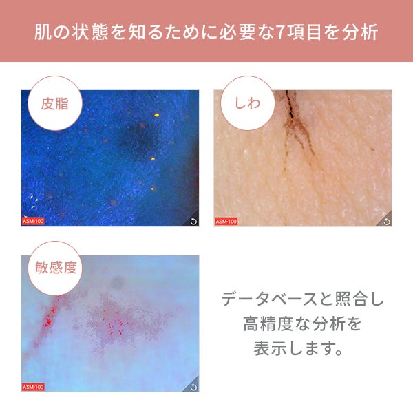 肌カウンセリングスコープ ASM