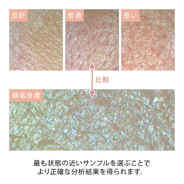 肌カウンセリングスコープ ASM