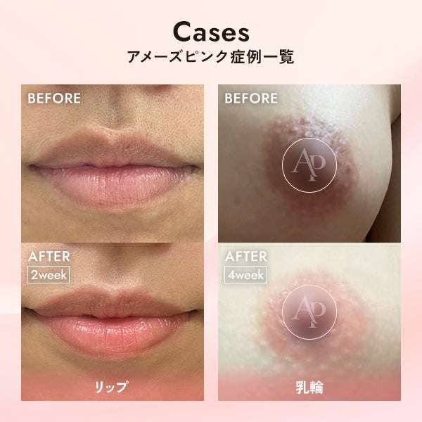 [アメーズピンク] セラム1 5mL (6本セット)