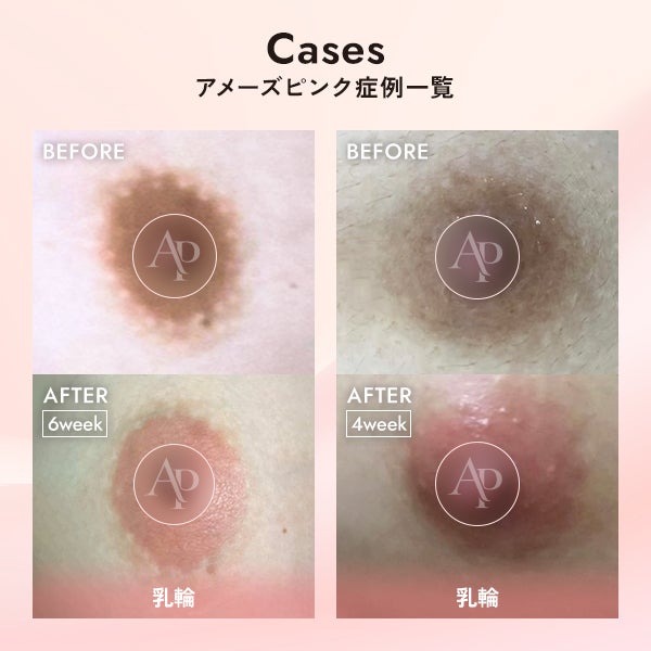 [アメーズピンク] セラム1 5mL (6本セット)